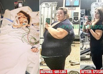 دو سالوں میں 173 پاؤنڈ وزن کم کرنے والی فٹنس بلاگر موت کے دھانے پر