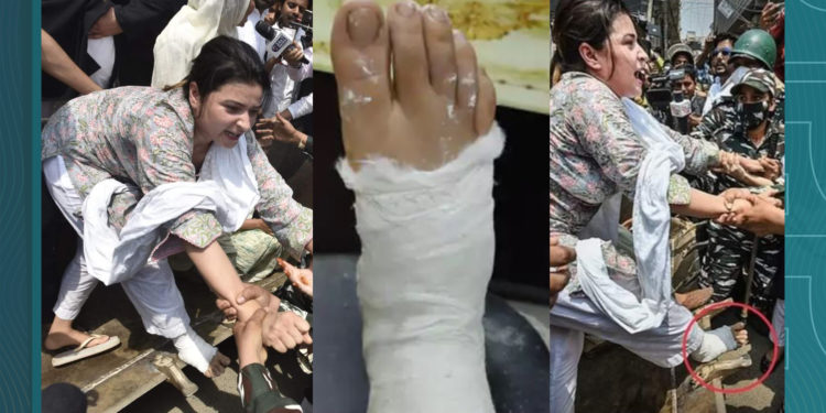 ٹوٹی ٹانگ لیکن بلند حوصلے والی ” شاہین باغ کی شیرنی” کون؟