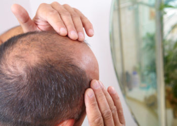 مردوں کو ”گنجا” پکارنا جنسی طور پر ہراساں کرنے کے برابر